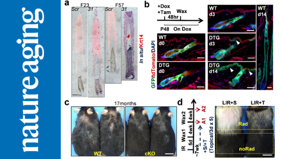 營養與健康所張亮研究組合作發現皮膚上皮組織衰老的新調控機制與潛在治療標靶