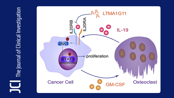 營養(yǎng)與健康所胡國宏研究組發(fā)現(xiàn)肺癌骨轉(zhuǎn)移調(diào)控新機制