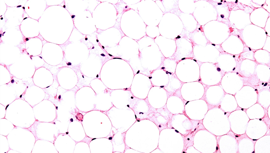 營養與健康所翟琦巍研究組研究成果獲Nature研究亮點專評